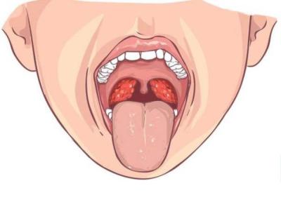 نحوه تشخیص و روش های درمانی سرطان دهان